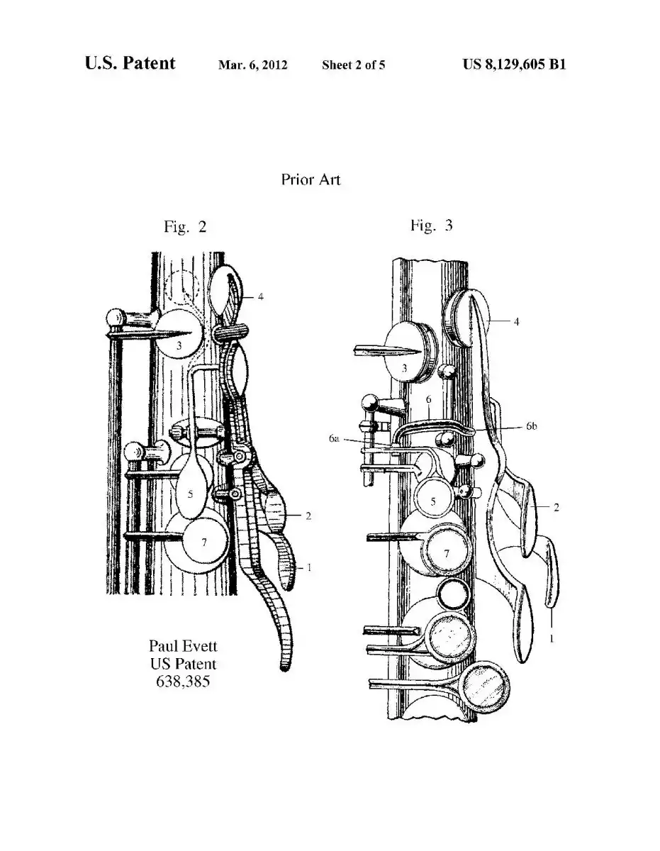 Tech/maintenance - How Feasible Is It To Add A Front F To A Sax Without ...